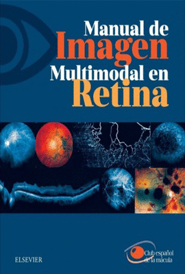 MANUAL DE IMAGEN MULTIMODAL EN RETINA