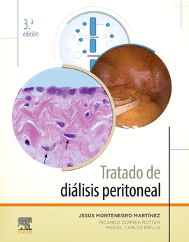 TRATADO DE DIALISIS PERITONEAL