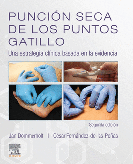 PUNCIN SECA DE LOS PUNTOS GATILLO