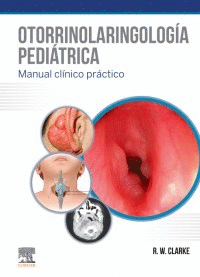 OTORRINOLARINGOLOGIA PEDIATRICA