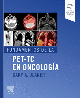 FUNDAMENTOS DE LA PET-TC EN ONCOLOGA