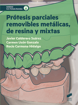 PROTESIS PARCIALES REMOVIBLES METALICAS, DE RESINA Y MIXTAS