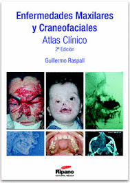 ENFERMEDADES MAXILARES Y CRANEOFACIALES