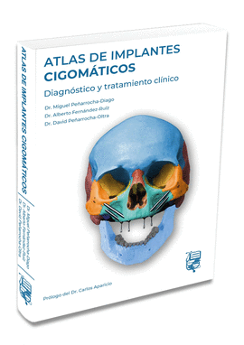 ATLAS DE IMPLANTES CIGOMTICOS