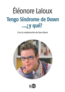 TENGO S�NDROME DE DOWN ...�Y QU�?