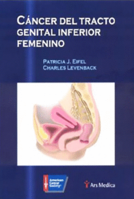 CANCER DEL TRACTO GENITAL INFERIOR FEMENINO