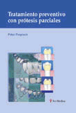 TRATAMIENTO PREVENTIVO CON PROTESIS PARCIALES