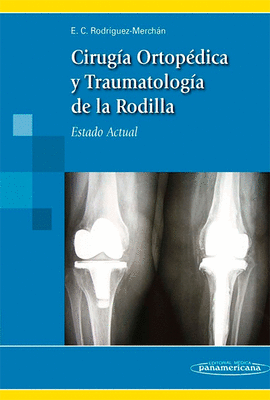 CIRUG�A ORTOP�DICA Y TRAUMATOLOG�A DE LA RODILLA. ESTADO ACTUAL
