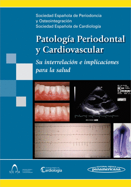 PATOLOGIA PERIODONTAL Y CARDIOVASCULAR SU INTERRELACION E IMPLICACIONES PARA LA SALUD