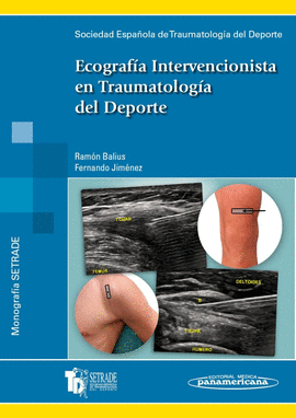 ECOGRAF�A INTERVENCIONISTA EN TRAUMATOLOG�A DEL DEPORTE