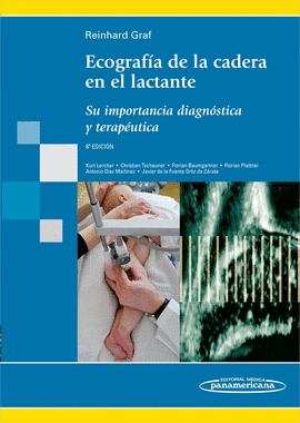 ECOGRAFIA DE LA CADERA EN EL LACTANTE SU IMPORTANCIA DIAGNOSTICA Y TERAPEUTICA