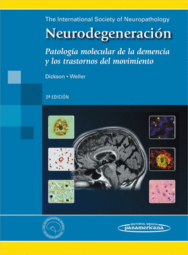NEURODEGENERACION PATOLOGIA MOLECULAR DE LA DEMENCIA Y LOS TRASTORNOS DEL MOVIMIENTO