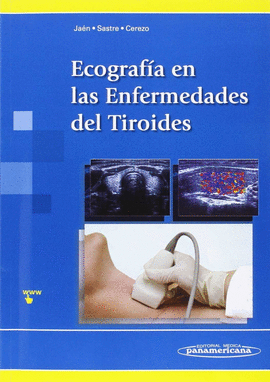 ECOGRAFA EN LAS ENFERMEDADES DEL TIROIDES