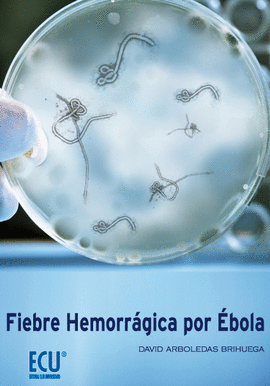 FIEBRE HEMORRAGICA POR EBOLA