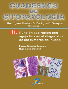CUADERNO DE CITOPATOLOGIA 11 PUNCION ASPIRACION CON AGUJA FINA EN EL DIAGNOSTICO DE LOS TUMORES DEL