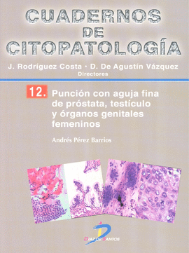 PUNCION CON AGUJA FINA DE PROSTATA TESTICULO Y ORGANOS GENITALES FEMENINOS CUADERNOS DE CITOPATOLOGI