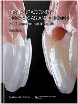 RESTAURACIONES CER�MICAS ANTERIORES. DETALLES QUE MARCAN DIFERENCIA