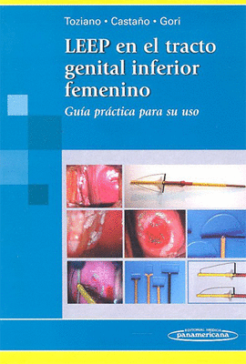 LEEP EN EL TRACTO GENITAL INFERIOR FEMENINO