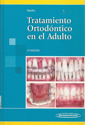 TRATAMIENTO ORTODONTICO EN EL ADULTO