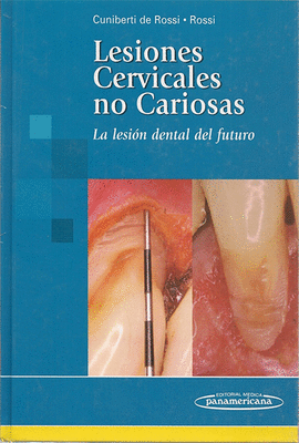 LESIONES CERVICALES NO CARIOSAS LA LESION DENTAL DEL FUTURO