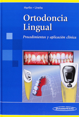 ORTODONCIA LINGUAL PROCEDIMIENTOS Y APLICACIONES CLINICA