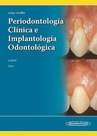 PERIODONTOLOGIA CLINICA E IMPLANTOLOGIA ODONTOLOGICA TOMO 2