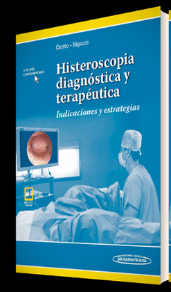 HISTEROSCOPIA DIAGNSTICA Y TERAPUTICA