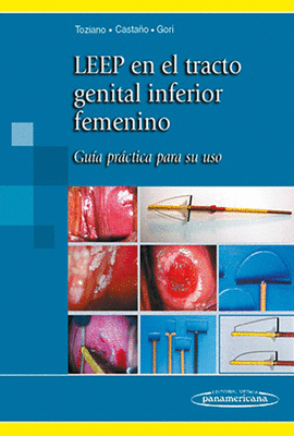 LEEP EN EL TRACTO GENITAL INFERIOR FEMENINO