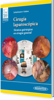 CIRUG�A LAPAROSC�PICA
