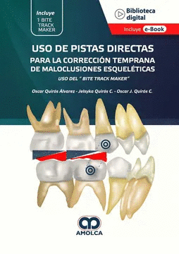 USO DE PISTAS DIRECTAS PARA LA CORRECCION TEMPRANA DE MALOCLUSIONES ESQUELETICAS
