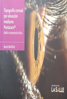 TOPOGRAF�A CORNEAL POR ELEVACI�N MEDIANTE PENTACAM�