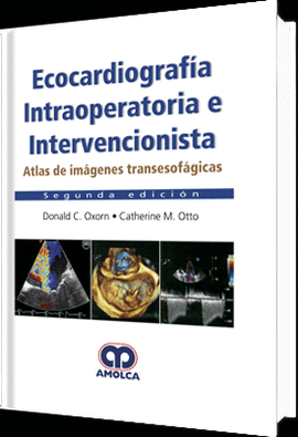ECOCARDIOGRAF�A INTRAOPERATORIA E INTERVENCIONISTA