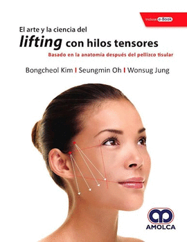 EL ARTE Y LA CIENCIA DEL LIFTING CON HILOS TENSORES. BASADO EN LA ANATOM�A DESPU�S DEL PELLIZCO TISULAR