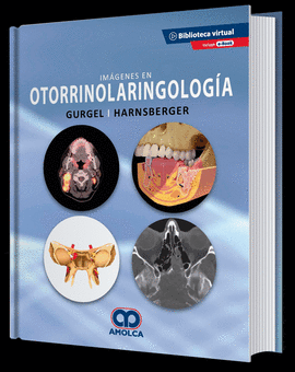 IM�GENES EN OTORRINOLARINGOLOG�A