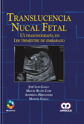 TRANSLUCENCIA NUCAL FETAL