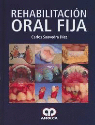 REHABILITACIN ORAL FIJA