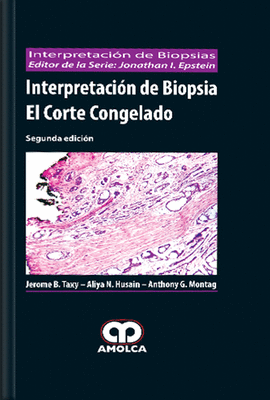 INTERPRETACIN DE BIOPSIA