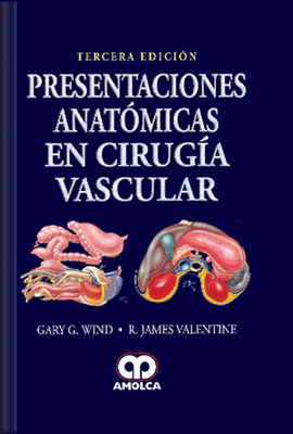 PRESENTACIONES ANATMICAS EN CIRUGA VASCULAR