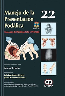 MANEJO DE LA PRESENTACION PODALICA 22