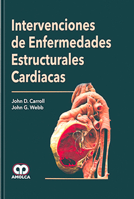 INTERVENCIONES DE ENFERMEDADES ESTRUCTURALES CARDIACAS
