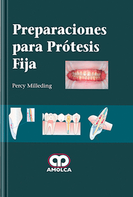 PREPARACIONES PARA PROTESIS FIJA