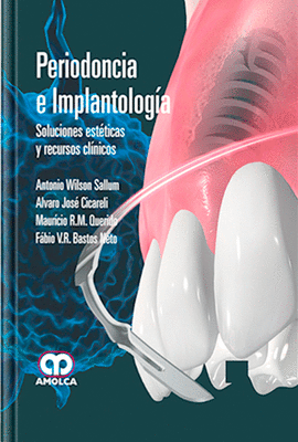 PERIODONCIA E IMPLANTOLOG�A