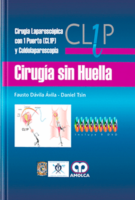CIRUGIA SIN HUELLA CIRUGIA LAPAROSCOPICA