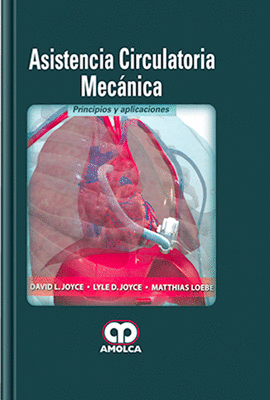 ASINTENCIA CIRCULATORIA MECANICA