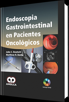 ENDOSCOPIA GASTROINTESTINAL EN PACIENTES ONCOL�GICOS