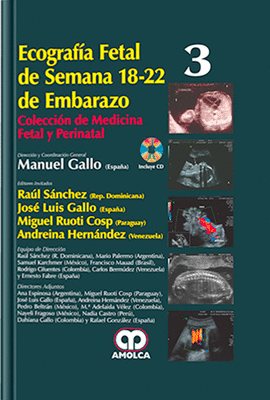 ECOGRAF�A FETAL DE SEMANA 18-22 DE EMBARAZO