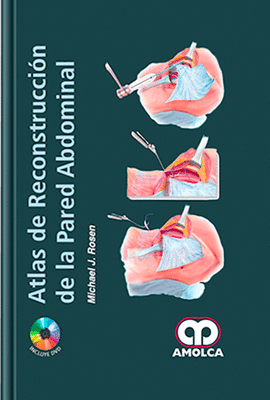ATLAS DE RECONSTRUCCION DE LA PARED ABDOMINAL