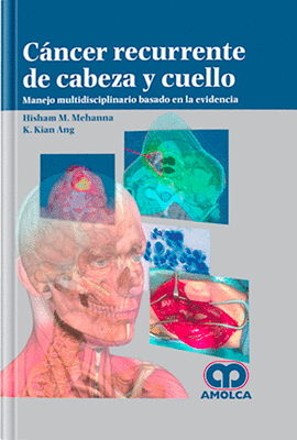 CANCER RECURRENTE DE CABEZA Y CUELLO