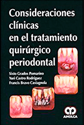 CONSIDERACIONES CL�NICAS EN EL TRATAMIENTO QUIR�RGICO PERIODONTAL