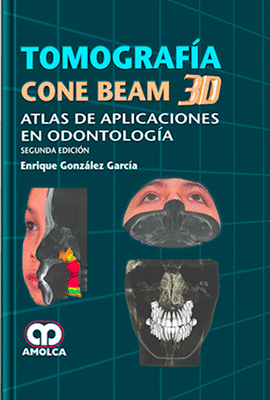 TOMOGRAF�A CONE BEAM 3D ATLAS DE APLICACIONES EN ODONTOLOG�A